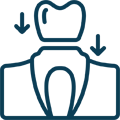 Dental implant icon showing tooth with downward arrows and foundation structure.