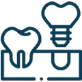 Dental implant icon showing tooth replacement procedure with implant components and natural tooth diagram.