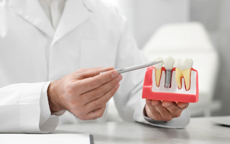 Doctor showing dental implant dummy to give information about its durability.