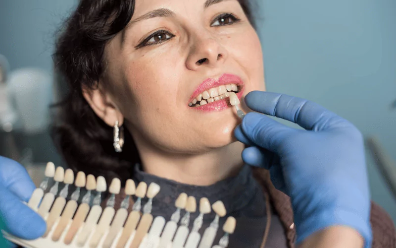 Things to Consider When Having Cosmetic Dentistry