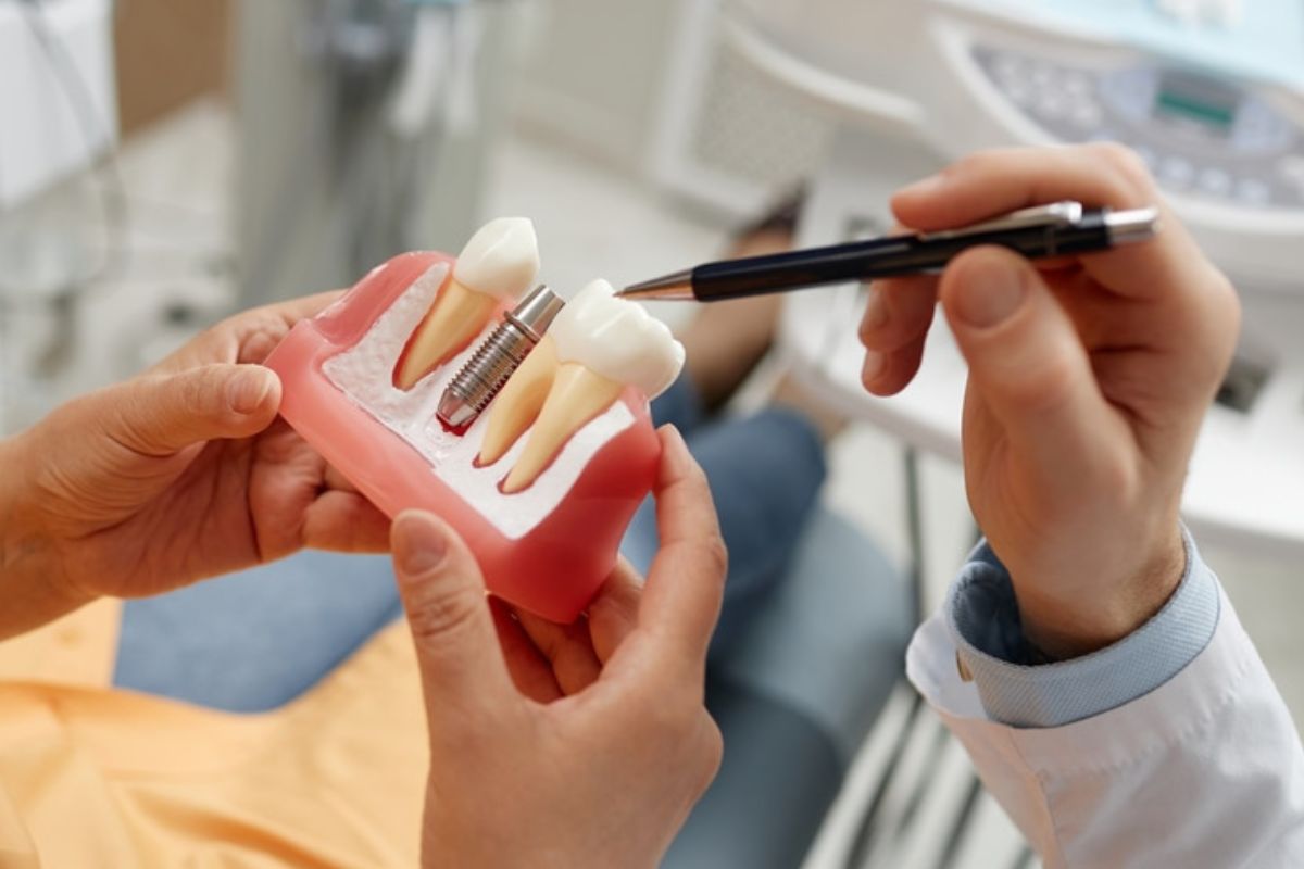 Does Smoking Affect Dental Implant Healing