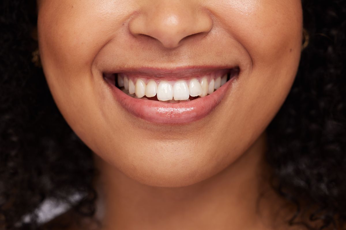 How Can a Dentist Help in Teeth Whitening Without Damaging Enamel?